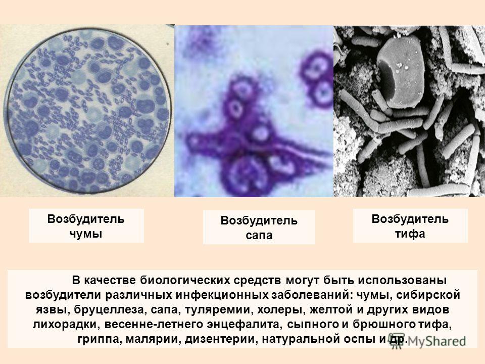 Возбудитель сыпного тифа тест. Чума холера Сибирская язва. Сыпной тиф возбудитель. Чума возбудитель болезни. Возбудители биологического оружия.